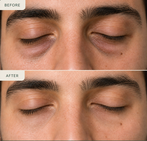Feature product image